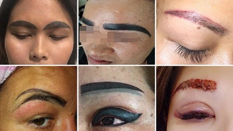 Xăm lông mày có thể mang lại những kết quả không như mong muốn