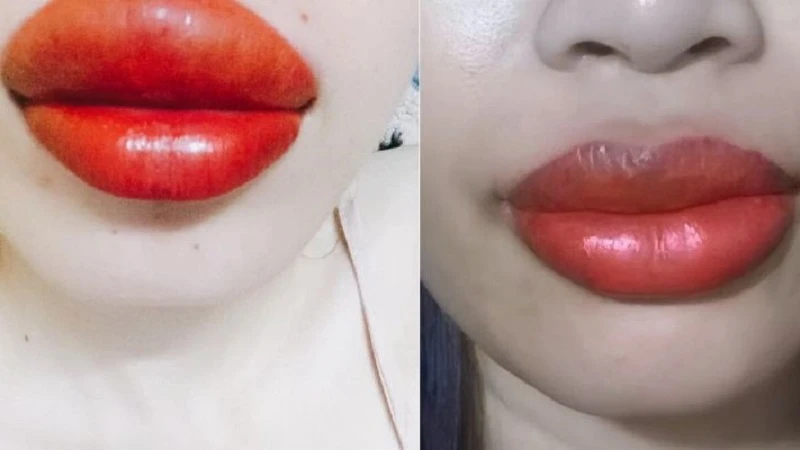 Sau khi xăm môi có thể bị sưng tùy theo cơ địa mỗi người