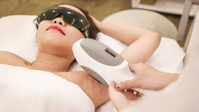 Công nghệ triệt lông bằng laser là một trong những phương pháp triệt lông không đau