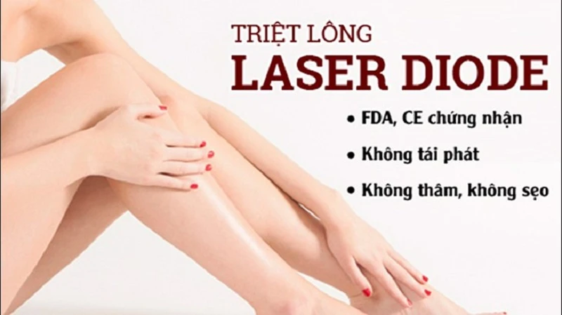 Laser Diode là một trong những công nghệ triệt lông được sử dụng phổ biến trên thị trường