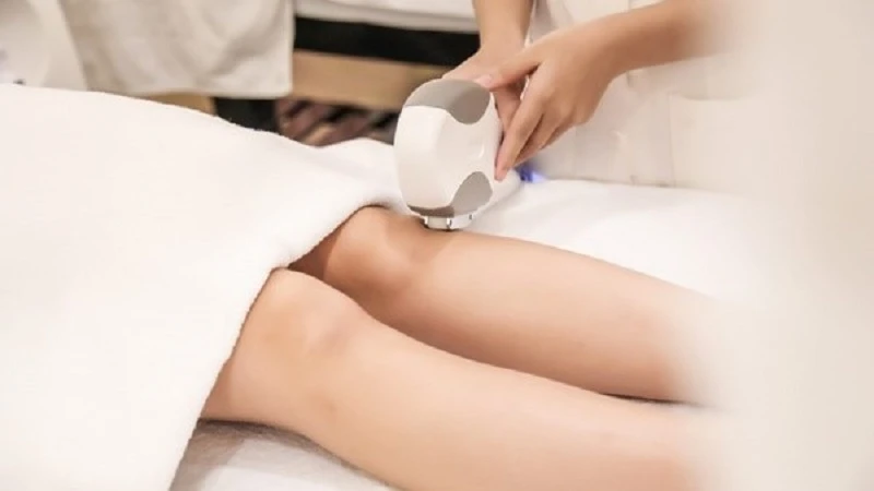 Triệt lông bàng laser là phương pháp triệt long hiện đại mang lại hiệu quả lâu dài