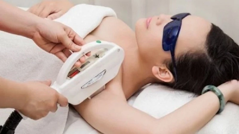 Triệt lông nách bằng công nghệ IPL là một phương pháp mang lại hiệu quả cao