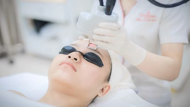 Điều trị sẹo rỗ bằng laser là một phương pháp điều trị an toàn và hiện đại